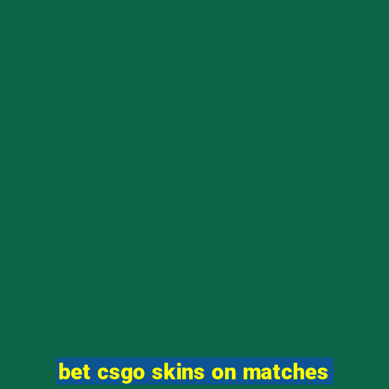 bet csgo skins on matches