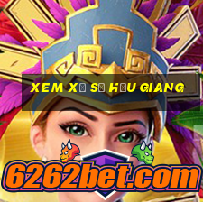 xem xổ số hậu giang