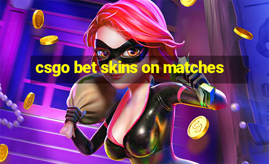 csgo bet skins on matches