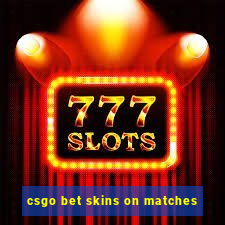 csgo bet skins on matches