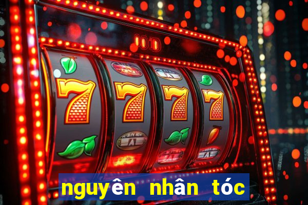 nguyên nhân tóc nhanh bết