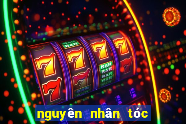 nguyên nhân tóc nhanh bết